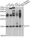 Cystatin-SN antibody, A6570, ABclonal Technology, Western Blot image 