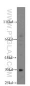 Family With Sequence Similarity 49 Member B antibody, 20127-1-AP, Proteintech Group, Western Blot image 