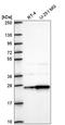 1-Acylglycerol-3-Phosphate O-Acyltransferase 1 antibody, HPA073355, Atlas Antibodies, Western Blot image 
