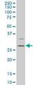 Dickkopf WNT Signaling Pathway Inhibitor 1 antibody, ab61275, Abcam, Western Blot image 