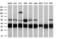 Capping Actin Protein Of Muscle Z-Line Subunit Alpha 1 antibody, M07665, Boster Biological Technology, Western Blot image 