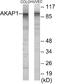 A-Kinase Anchoring Protein 1 antibody, EKC1889, Boster Biological Technology, Western Blot image 