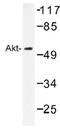 Akt antibody, AP01349PU-N, Origene, Western Blot image 