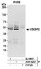 CD2 Cytoplasmic Tail Binding Protein 2 antibody, A304-826A, Bethyl Labs, Immunoprecipitation image 