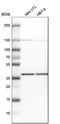 Dimethylarginine Dimethylaminohydrolase 1 antibody, HPA006308, Atlas Antibodies, Western Blot image 