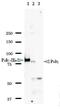 DNA Polymerase Eta antibody, GTX00871, GeneTex, Western Blot image 