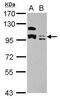 Potassium Channel Tetramerization Domain Containing 19 antibody, PA5-32114, Invitrogen Antibodies, Western Blot image 