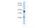Homeobox protein engrailed-1 antibody, P100923_P050, Aviva Systems Biology, Western Blot image 
