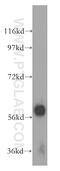 Pancreatic alpha-amylase antibody, 15845-1-AP, Proteintech Group, Western Blot image 
