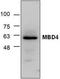 Methyl-CpG Binding Domain 4, DNA Glycosylase antibody, TA318862, Origene, Western Blot image 
