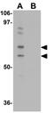 Ubiquitin Like Modifier Activating Enzyme 2 antibody, GTX31804, GeneTex, Western Blot image 