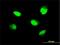 Zinc Finger Protein 207 antibody, H00007756-M09, Novus Biologicals, Immunofluorescence image 
