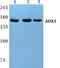 Ro antibody, PA5-36922, Invitrogen Antibodies, Western Blot image 