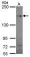 Centrosomal protein of 164 kDa antibody, GTX70094, GeneTex, Western Blot image 