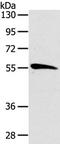 Cell Division Cycle 25A antibody, TA323117, Origene, Western Blot image 