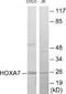 Homeobox A7 antibody, EKC1706, Boster Biological Technology, Western Blot image 