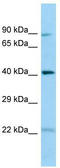 Chitinase Domain Containing 1 antibody, TA331383, Origene, Western Blot image 