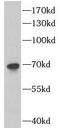 Dihydrolipoamide S-Acetyltransferase antibody, FNab02404, FineTest, Western Blot image 