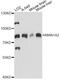 Mannosidase Alpha Class 1A Member 2 antibody, A14271, ABclonal Technology, Western Blot image 