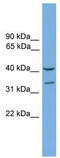 Forkhead Box S1 antibody, TA342258, Origene, Western Blot image 