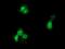 Glucokinase regulatory protein antibody, MA5-25352, Invitrogen Antibodies, Immunocytochemistry image 