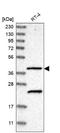 Solute Carrier Family 43 Member 2 antibody, NBP1-82706, Novus Biologicals, Western Blot image 
