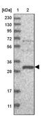 EF-Hand Calcium Binding Domain 2 antibody, PA5-56673, Invitrogen Antibodies, Western Blot image 