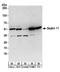 Septin 11 antibody, A304-176A, Bethyl Labs, Western Blot image 