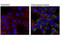Microtubule Associated Protein 1 Light Chain 3 Beta antibody, 4108S, Cell Signaling Technology, Immunofluorescence image 