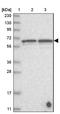 Dentin matrix acidic phosphoprotein 1 antibody, NBP1-89484, Novus Biologicals, Western Blot image 