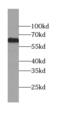 Leucine Rich Repeat Containing 71 antibody, FNab01071, FineTest, Western Blot image 