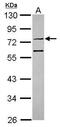 Intraflagellar Transport 74 antibody, GTX118199, GeneTex, Western Blot image 