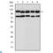 Bone Morphogenetic Protein Receptor Type 2 antibody, LS-C812515, Lifespan Biosciences, Enzyme Linked Immunosorbent Assay image 