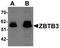 Zinc Finger And BTB Domain Containing 3 antibody, NBP1-76516, Novus Biologicals, Western Blot image 