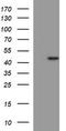 Matrix Metallopeptidase 13 antibody, TA506806, Origene, Western Blot image 