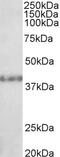 Histone-lysine N-methyltransferase SUV39H2 antibody, 46-451, ProSci, Western Blot image 
