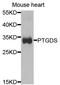 Prostaglandin D2 Synthase antibody, A1889, ABclonal Technology, Western Blot image 