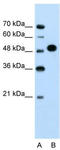 Makorin Ring Finger Protein 1 antibody, TA329833, Origene, Western Blot image 