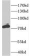 Cleavage Stimulation Factor Subunit 3 antibody, FNab02040, FineTest, Western Blot image 