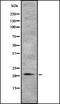 TGFB Induced Factor Homeobox 2 Like Y-Linked antibody, orb337547, Biorbyt, Western Blot image 