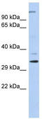 Actin Related Protein 2/3 Complex Subunit 2 antibody, TA344279, Origene, Western Blot image 