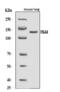 CD11C antibody, A00357-3, Boster Biological Technology, Western Blot image 