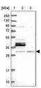 N(Alpha)-Acetyltransferase 80, NatH Catalytic Subunit antibody, PA5-58844, Invitrogen Antibodies, Western Blot image 