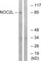 NOC2 Like Nucleolar Associated Transcriptional Repressor antibody, LS-C199334, Lifespan Biosciences, Western Blot image 