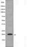 Protein Phosphatase 1 Regulatory Inhibitor Subunit 14C antibody, orb225905, Biorbyt, Western Blot image 