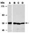 Keratin 2 antibody, orb67154, Biorbyt, Western Blot image 