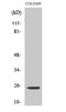 Homeobox protein Hox-1A antibody, A06154, Boster Biological Technology, Western Blot image 
