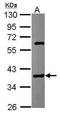 PCIF1 antibody, PA5-30546, Invitrogen Antibodies, Western Blot image 