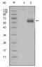 Dickkopf WNT Signaling Pathway Inhibitor 1 antibody, AM06319SU-N, Origene, Western Blot image 
