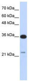 TP53 Target 5 antibody, TA335622, Origene, Western Blot image 